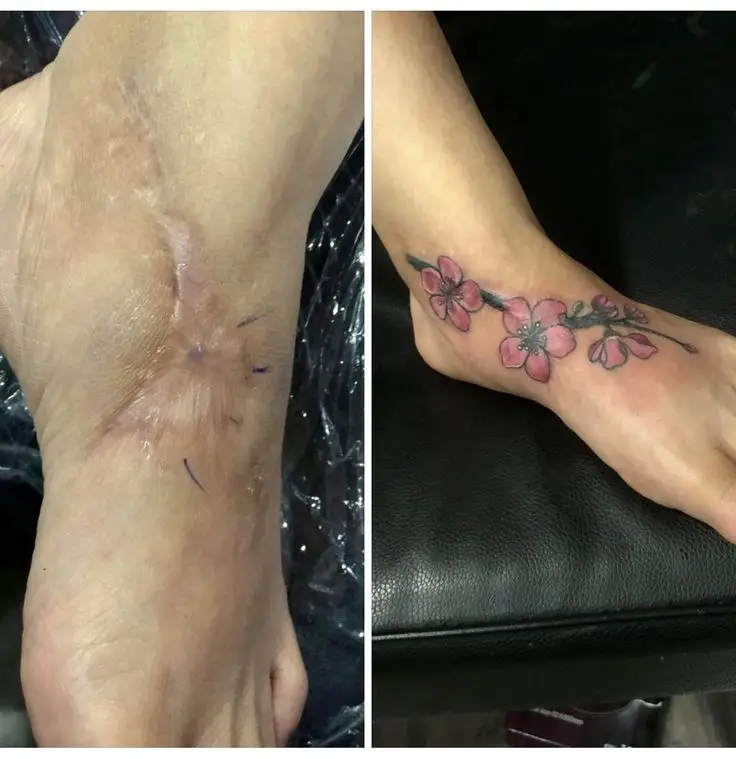 Che Sẹo Bằng Hình Xăm Đầu Gối Nữ Đẹp: Giải Pháp Nghệ Thuật 11